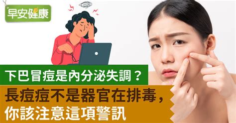 下巴生痘|下巴長痘痘代表的警訊是什麼？4方法改善痘痘問題